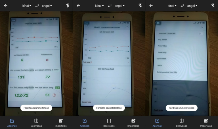 Xiaomi Mijia iHealth 2 vérnyomásmérő teszt 11