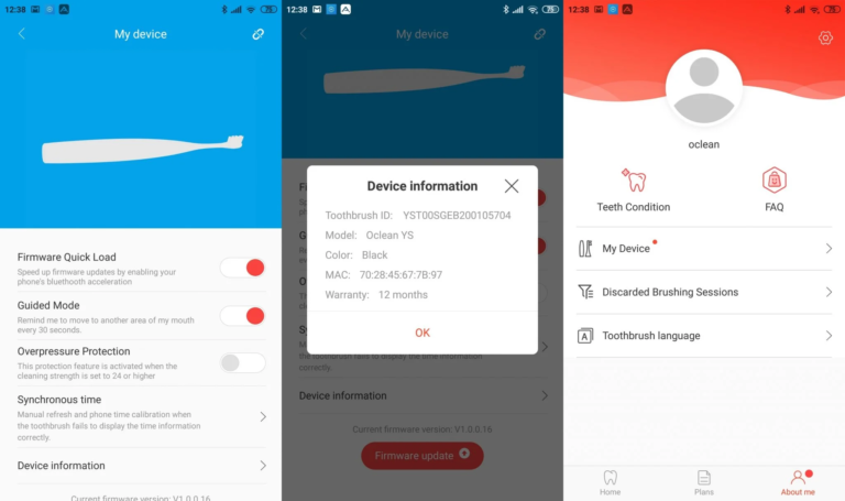 Xiaomi Oclean X Pro elektromos fogkefe teszt 16