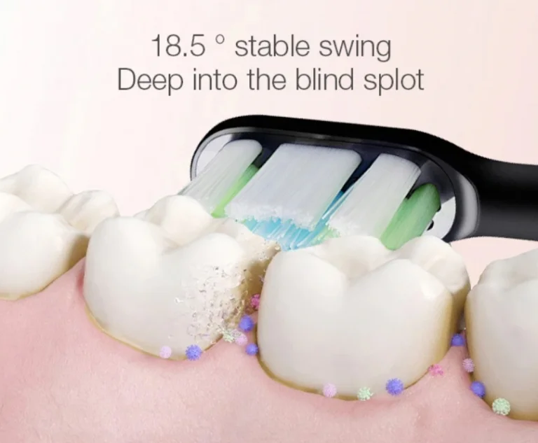 7400 forintért rendelhető a Soocas X3 a Banggood szülinapján 8