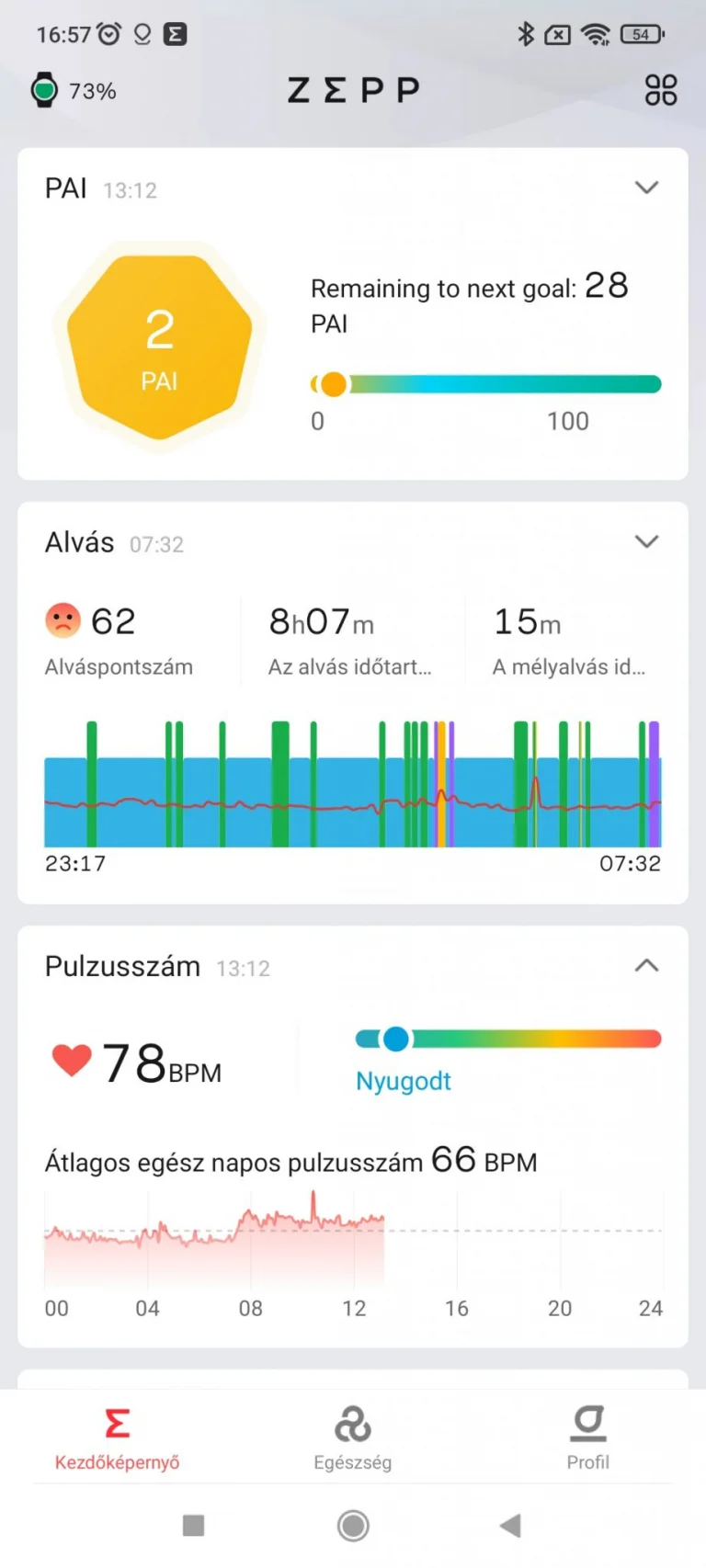 Xiaomi Amazfit GTR 2 sportóra teszt 26