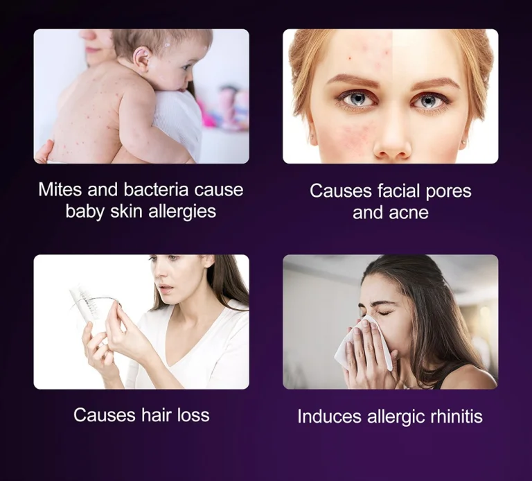 A Jimmy JV12 atkaeltávolító, hogy ne trüsszögj egész nap 5