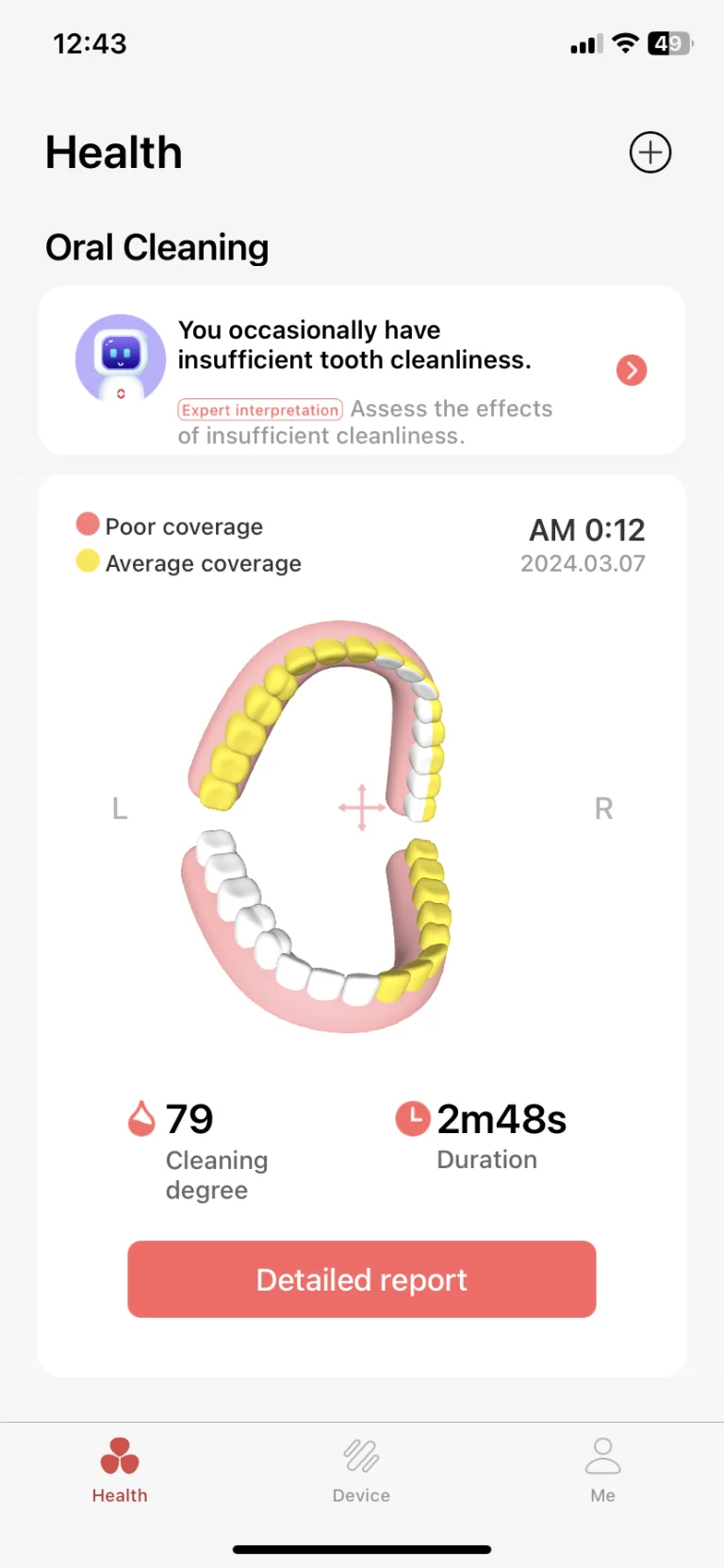 Oclean X Ultra S szónikus fogkefe teszt 29