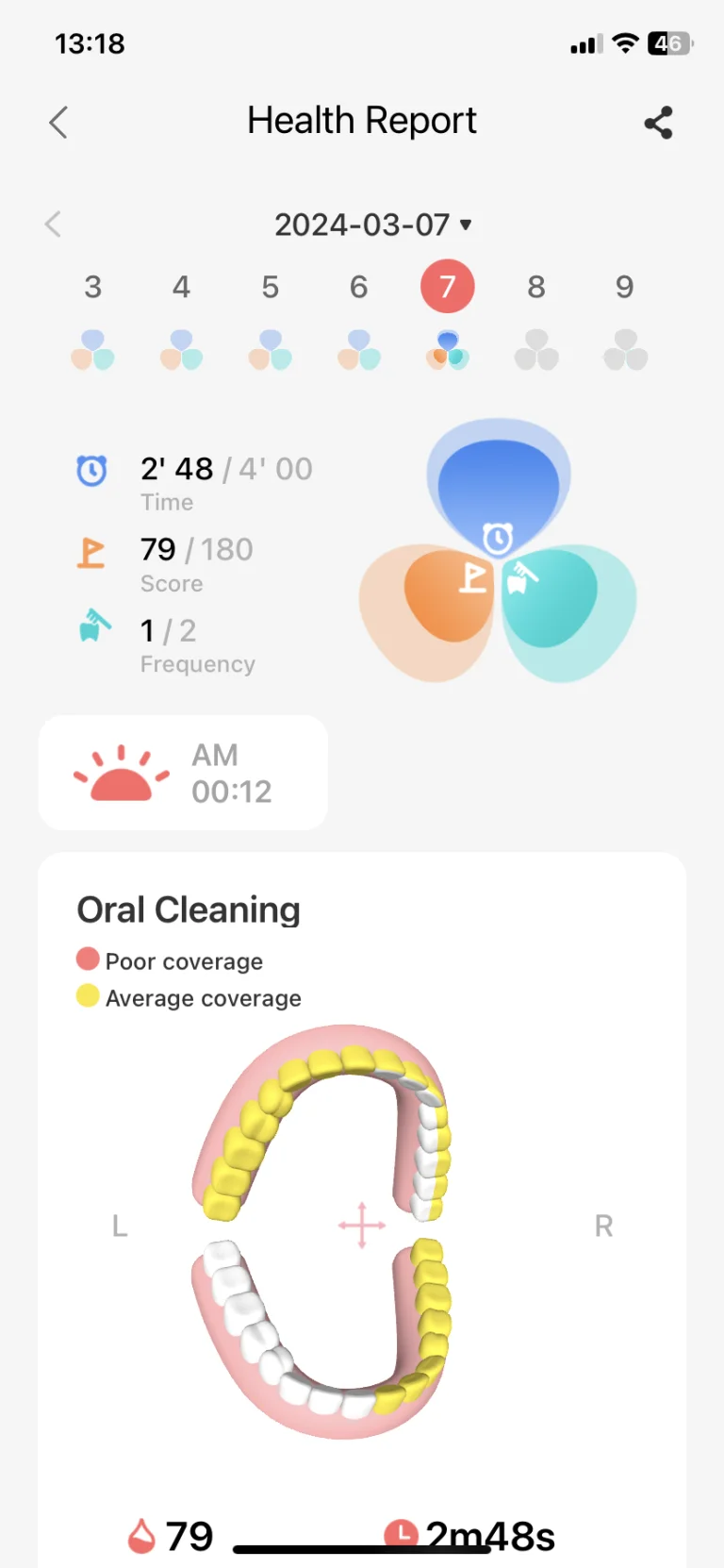Oclean X Ultra S szónikus fogkefe teszt 30