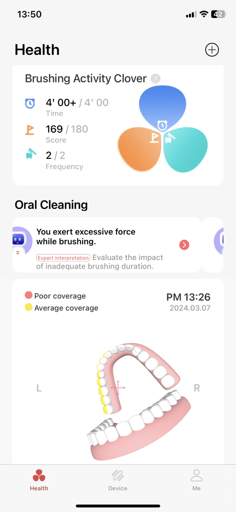 Oclean X Ultra S szónikus fogkefe teszt 32