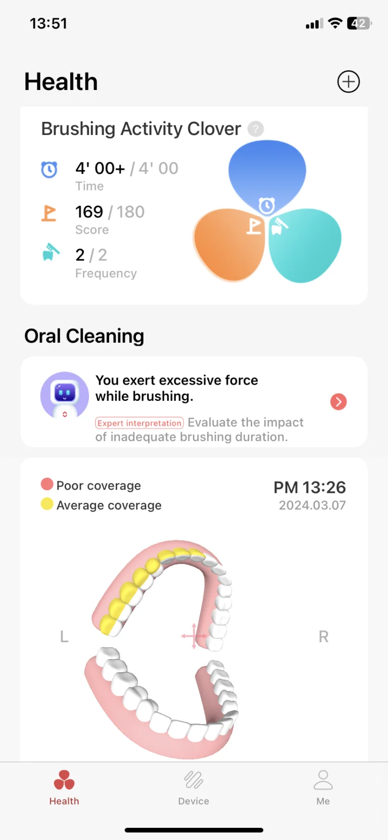 Oclean X Ultra S szónikus fogkefe teszt 33