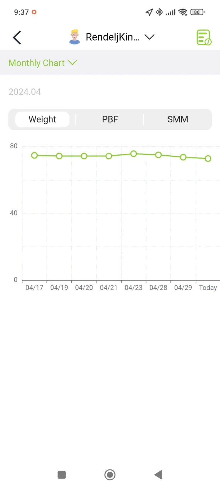 BodyPedia LM-S001 testösszetétel elemző okosmérleg teszt 37