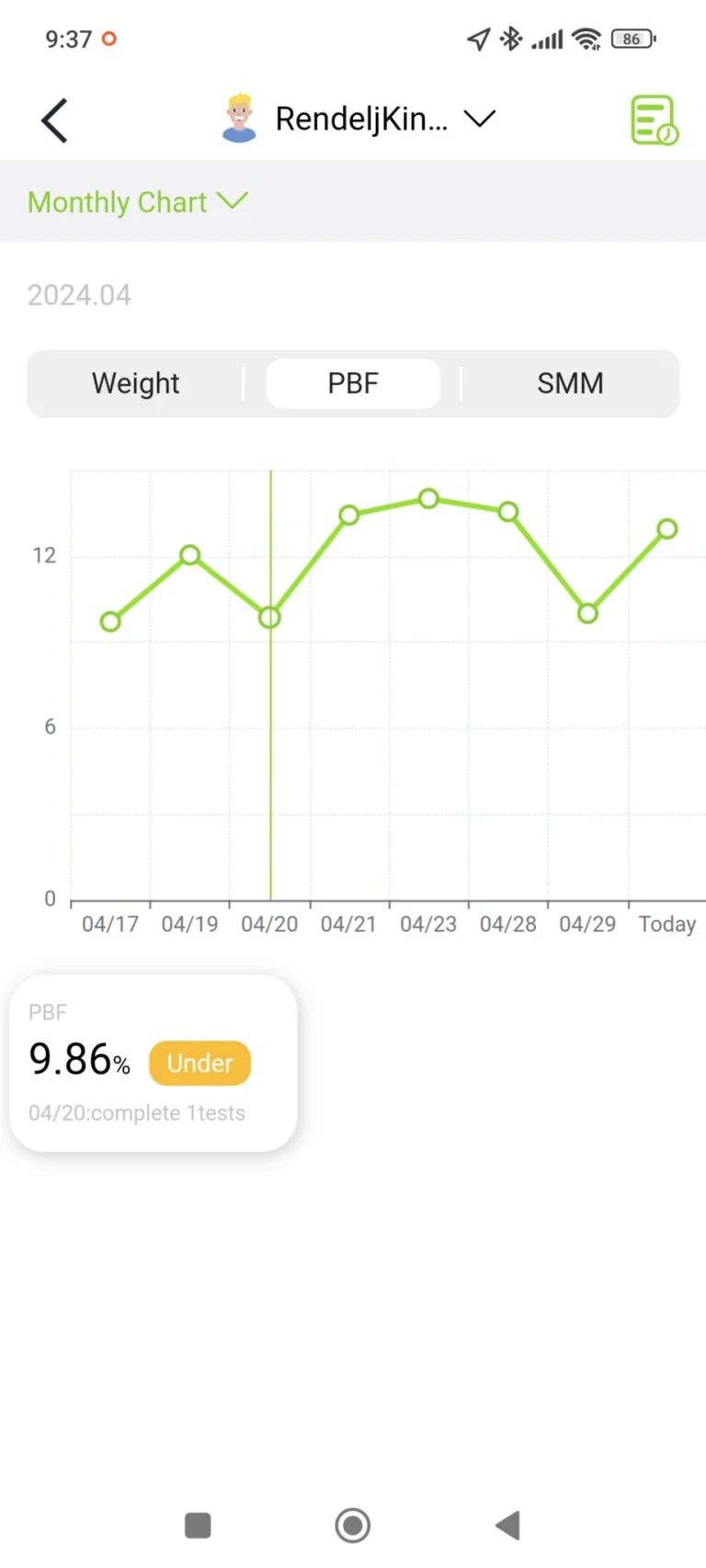 BodyPedia LM-S001 testösszetétel elemző okosmérleg teszt 41
